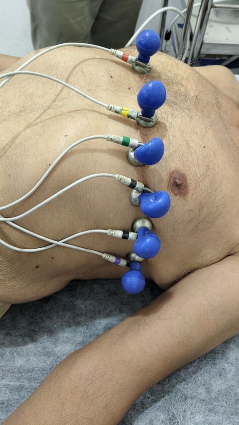 GE MAC 2000 Resting ECG