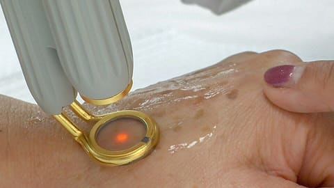 Aesthetic Laser Handpiece Refurbishment photo 5