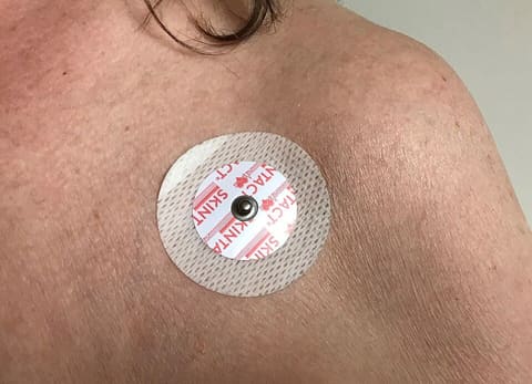 3M Red Dot ECG Electrodes (Case of 5,000) photo 3