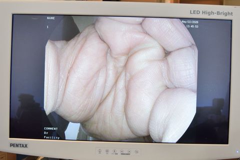 PENTAX EC38-i10NF Video colonoscope photo 4