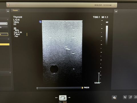 PHILIPS L12-5 Linear Probe photo 5