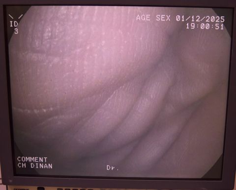 PENTAX ECY-1575K Video cystoscope photo 4