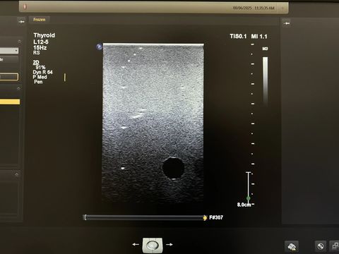 PHILIPS L12-5 Linear Probe photo 5