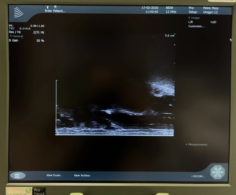 BK MEDICAL 8838 4D endocavity probe photo 2