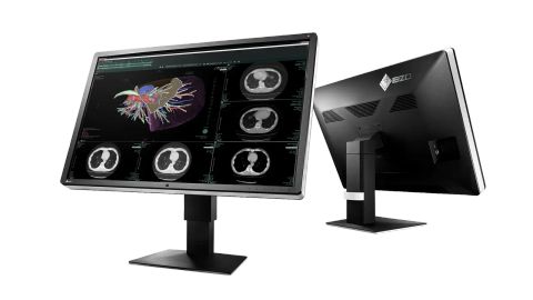 EIZO RadiForce RX660 Diagnostic Display