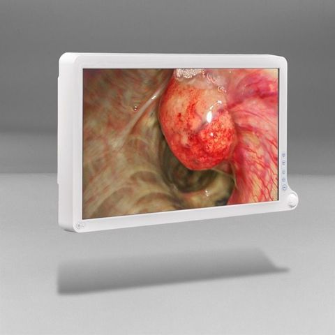 BARCO AMM215WTD Surgical Display photo 4