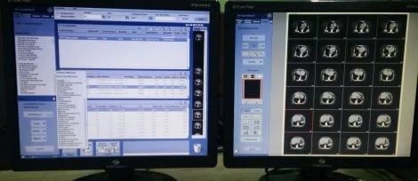 GE ADW 4.6 CT workstation