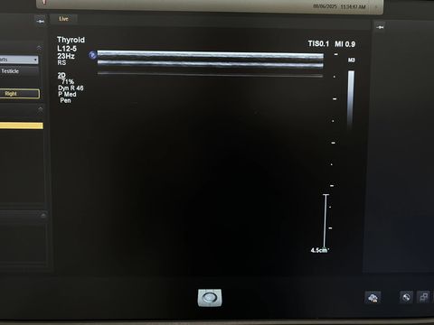 PHILIPS L12-5 Linear Probe photo 4