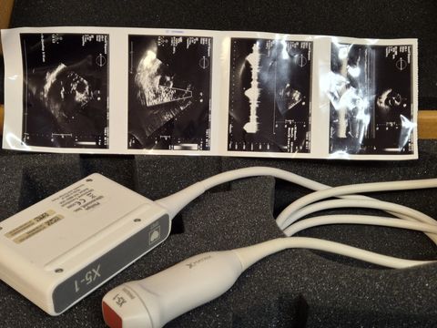 PHILIPS X5-1 Cardiac Probe