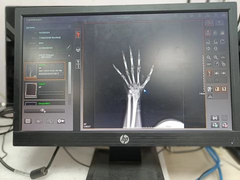 CARESTREAM DirectView Vita CR XE CR photo 2