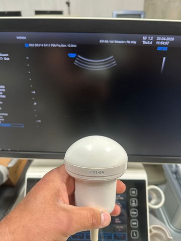 SAMSUNG UGEO WS80A Ultrasound Machine photo 3