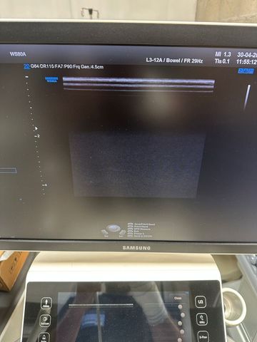 SAMSUNG UGEO WS80A Ultrasound Machine photo 2