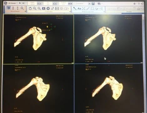 GE AW VolumeShare 7 CT workstation photo 3