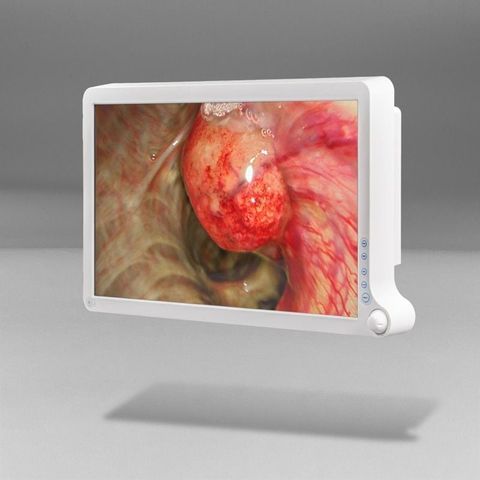 BARCO AMM215WTD Surgical Display