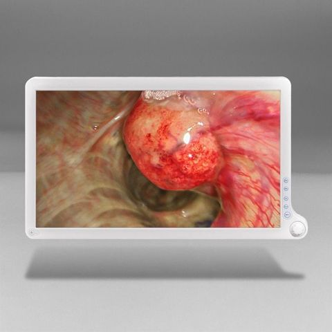BARCO AMM215WTD Surgical Display photo 3
