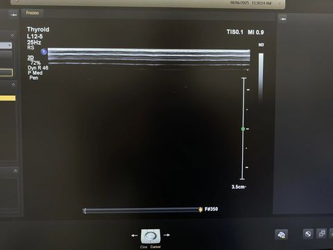 PHILIPS L12-5 Linear Probe photo 4