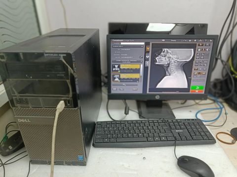 CARESTREAM Vita Flex CR photo 2
