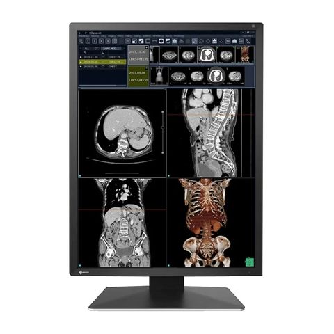 EIZO RadiForce RX270 Diagnostic Display