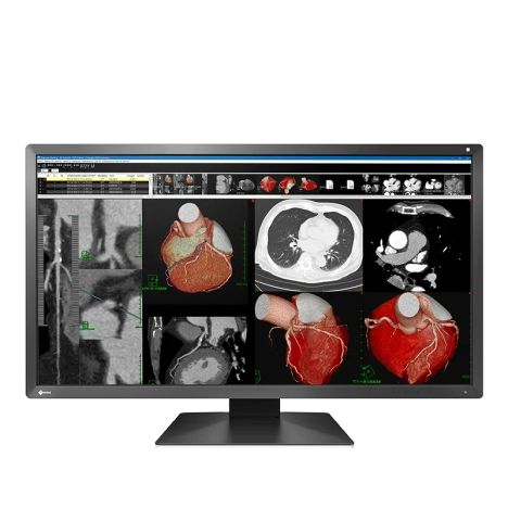 EIZO RadiForce MX317W Clinical Review Display