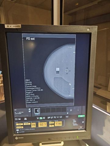 FUJIFILM Amulet S Mammography Machine photo 3