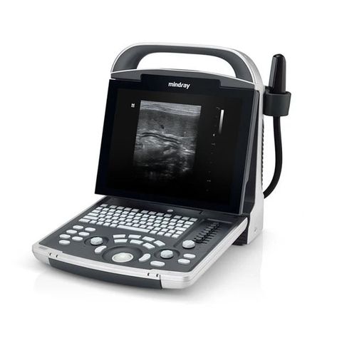 MINDRAY DP-30 Vet Ultrasound Machine